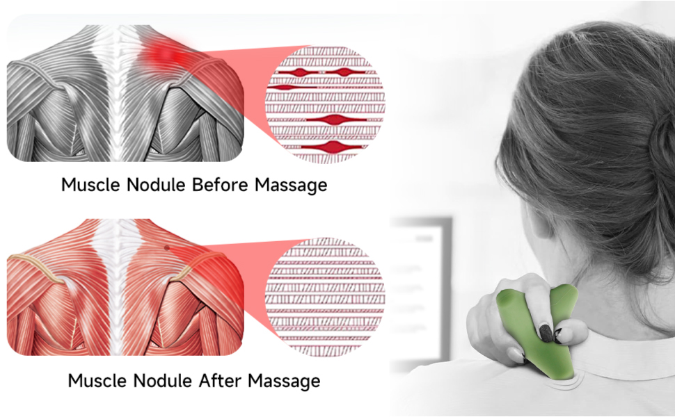 deep tissue recovery plantar fasciitis spiky ball planters facetious relief myofascial